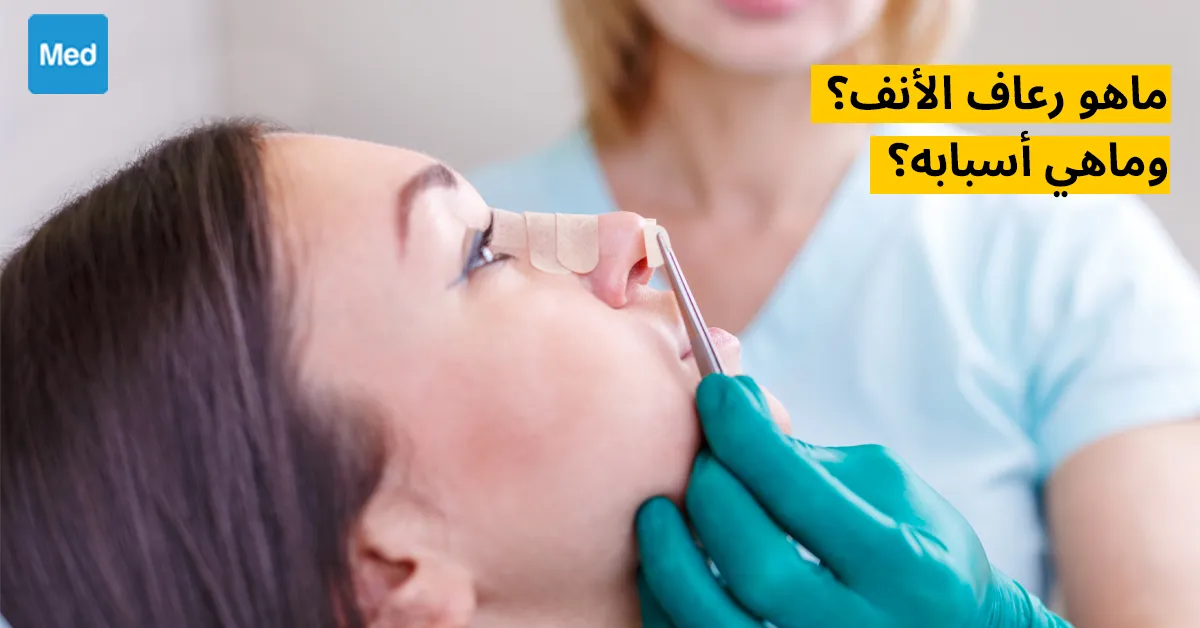 ماهو رعاف الأنف؟ وماهي أسبابه؟